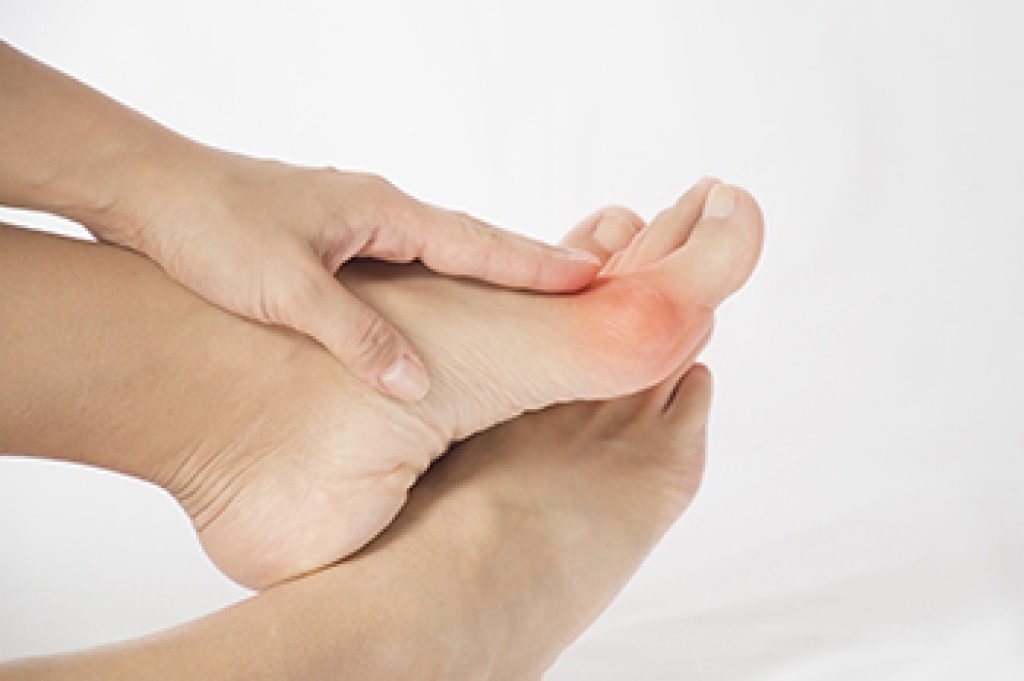 How a Podiatrist Can Help With Bunions