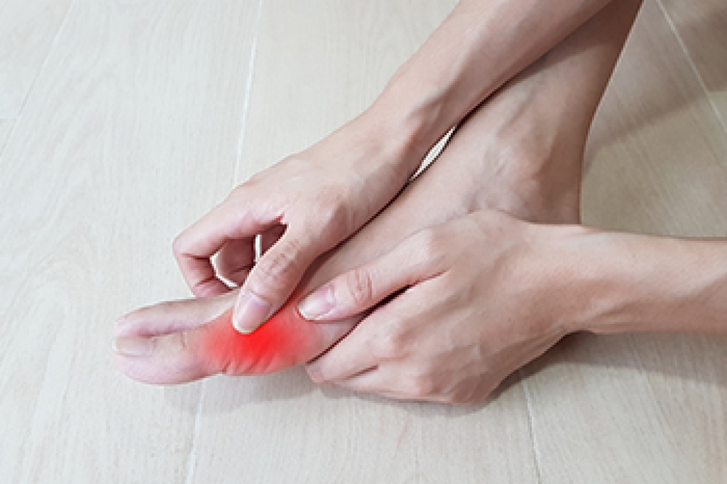 Recognizing Gout Pain in the Foot