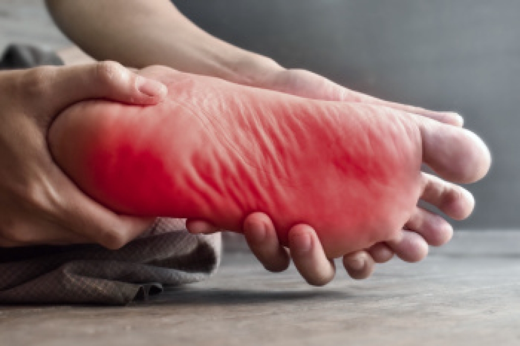 What Are Neuropathic Foot Ulcers?