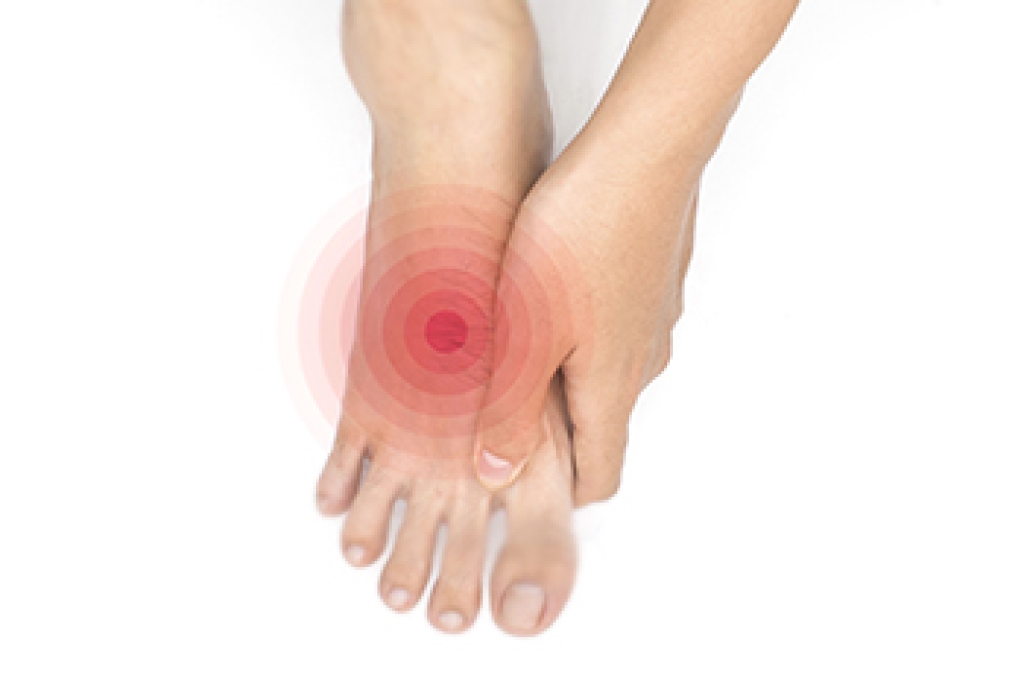 When Foot Symptoms May Signal Diabetic Neuropathy